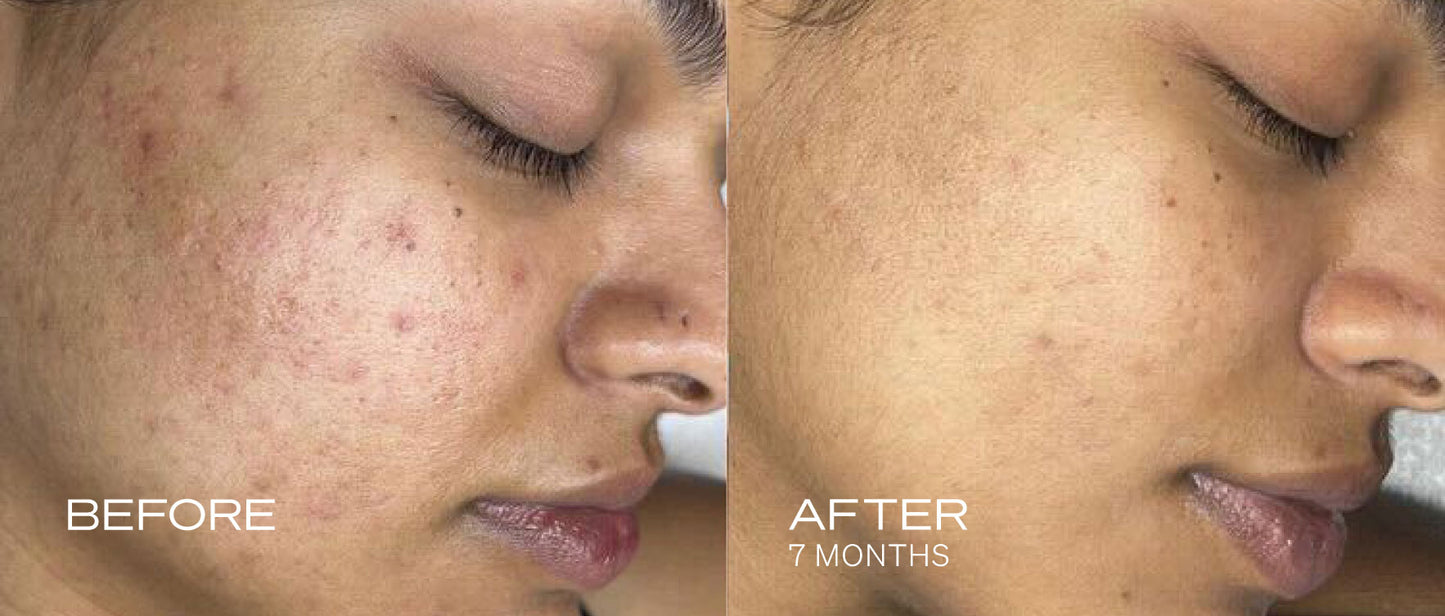 Glymed+ Pigment Brightening Serum